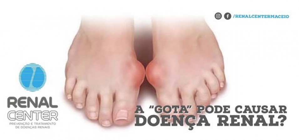 A 'Gota' pode causar doença renal?